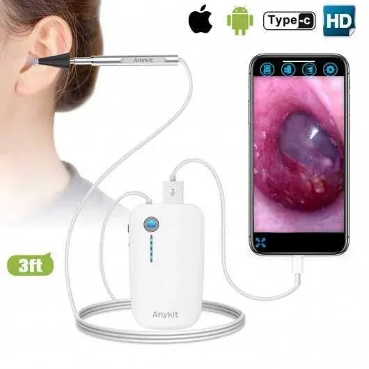 Anykit USB Otoscope for PC & Android Device(NOT for iPhone/iPad) Ultra Clear View Ear Camera with Ear Wax Removal Tool Waterproof Ear Scope Endosco