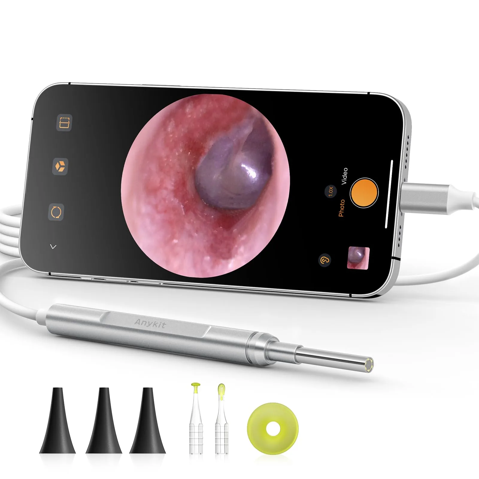 Anykit USB otoscope