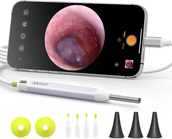 Anykit Digital Otoscope with Gyroscope, HD Ultra Clear View Ear Camera with Ear Wax Removal Tools, Video Ear Scope Otoscope with Light, Compatible with Android, iPhone 15 (Silver)